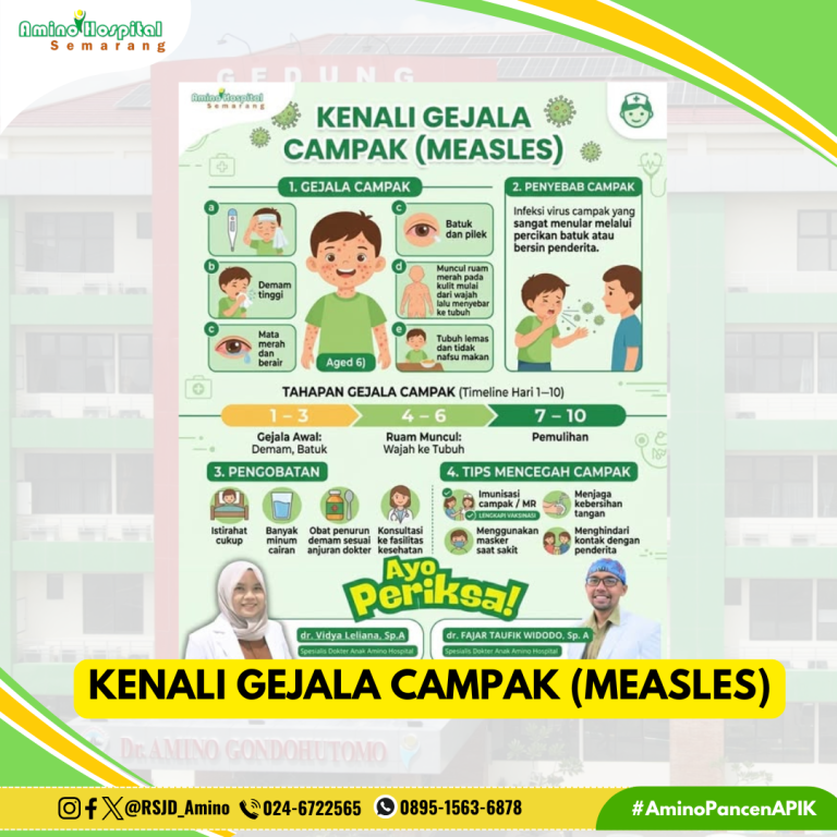 Kenali Gejala Campak (Measles)